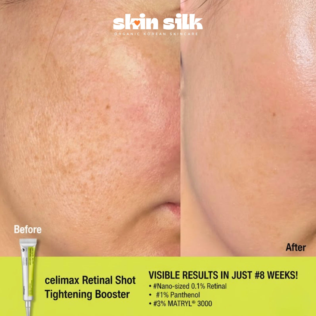 Celimax Retinal Shot Tightening Booster