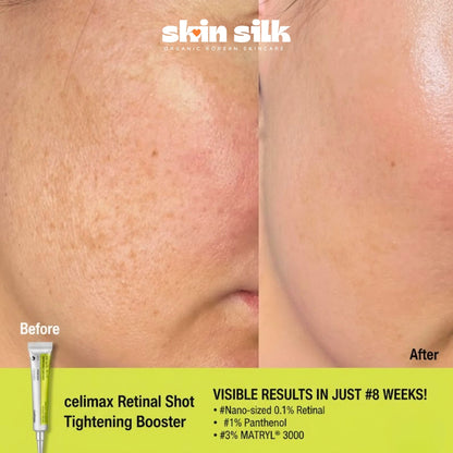 Celimax Retinal Shot Tightening Booster